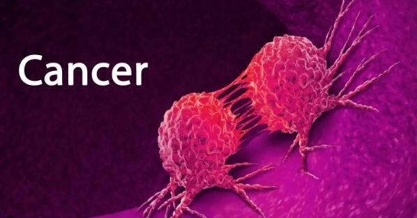 30 تا ۵۰ درصد سرطان‌ها قابل پیشگیری است / مردم به پیشگیری توجه کنند