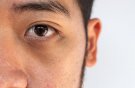 «چشم پاندایی» چیست؟