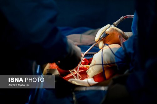 اهدای موفق اعضای بیمار «مرگ کامل» در بیمارستان فیروزگر