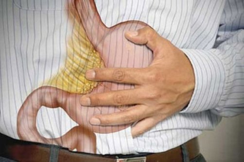 آنچه که باید درباره 